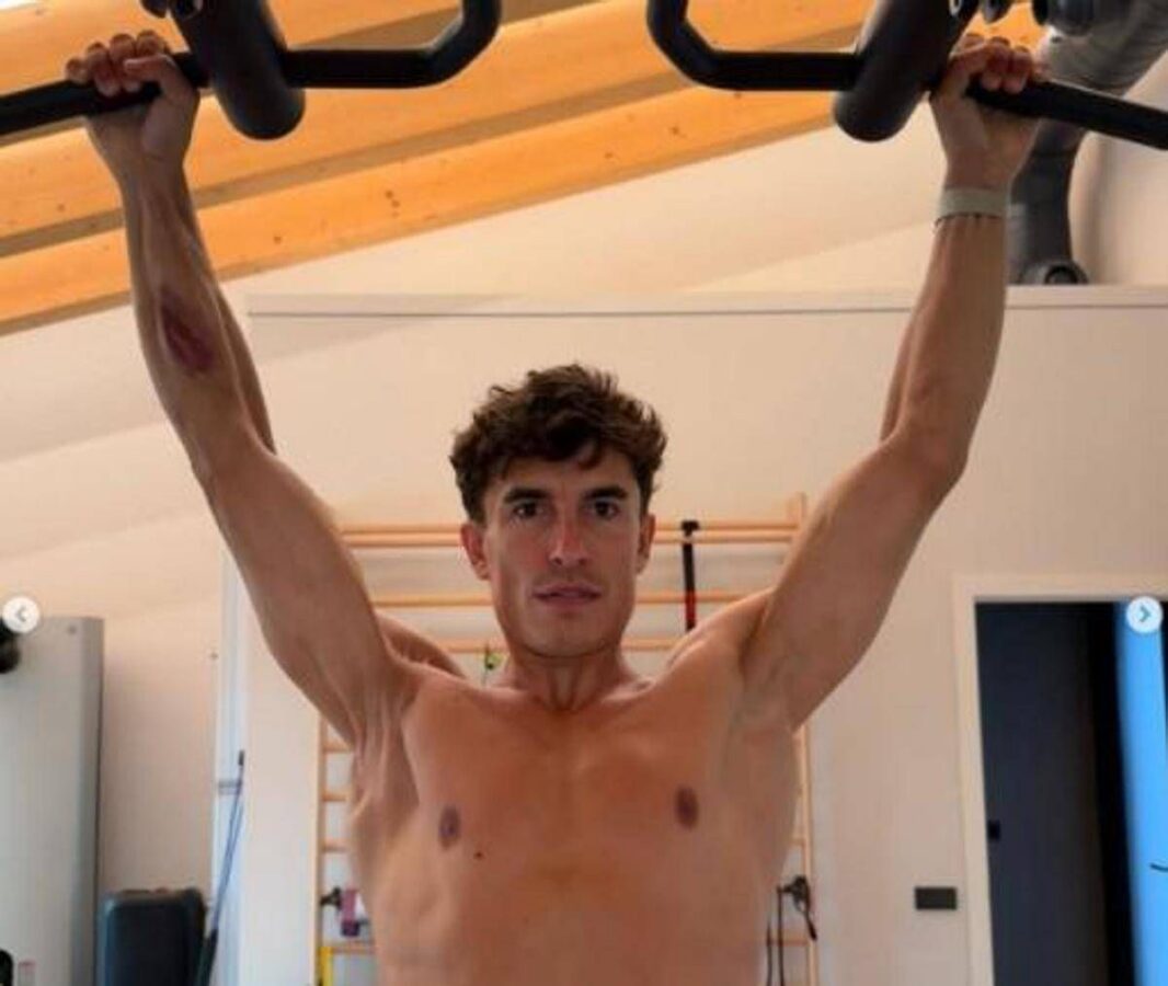 Marquez e la foto choc: il pilota mostra la spalla 'deformata'