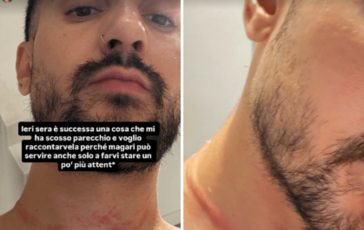 Mr. Daniel il make up artist dei vip aggredito e rapinato a Milano il racconto choc sui social 364x230