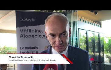 Salute Rossetti Aiv ‘associazione per accelerare riconoscimento nuove terapie vitiligine 364x230