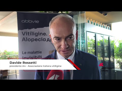 Salute: Rossetti (Aiv), ‘associazione per accelerare riconoscimento nuove terapie vitiligine’