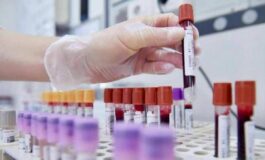 Sclerosi multipla recidivante Ema raccomanda approvazione ocrelizumab dai 10 anni 265x160