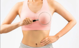 Tumori Andos celebra 50 anni Qualita di vita sia parte della cura nel cancro alla mammella 265x160