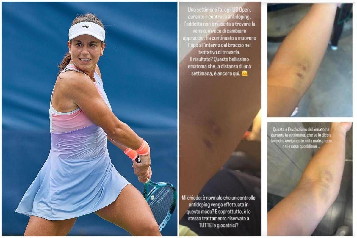 US Open, Stefanini and the bruise on her arm: "It was a doping test's fault..."