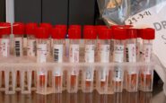 Germania malaria morto