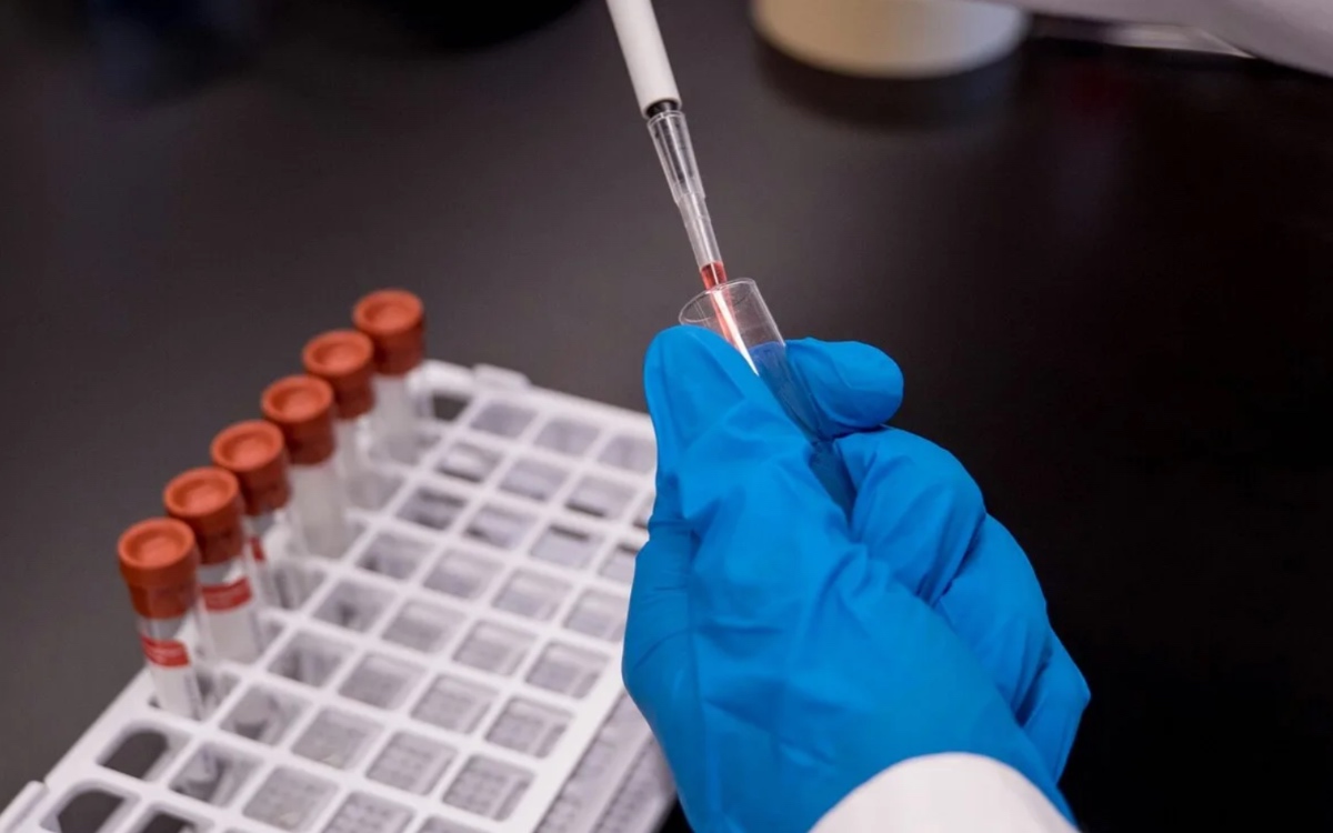 Influenza, vaccino al via da ottobre: chi deve farlo e per chi è gratuito