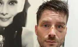 luca burini assurdo che le indagini non partano dufficio dopo unaggressione 265x160