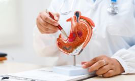 Cancro allo stomaco avanzato nuova terapia riduce del 42 il rischio di morte ﻿ 265x160