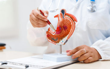 Cancro allo stomaco avanzato nuova terapia riduce del 42 il rischio di morte ﻿ 364x230