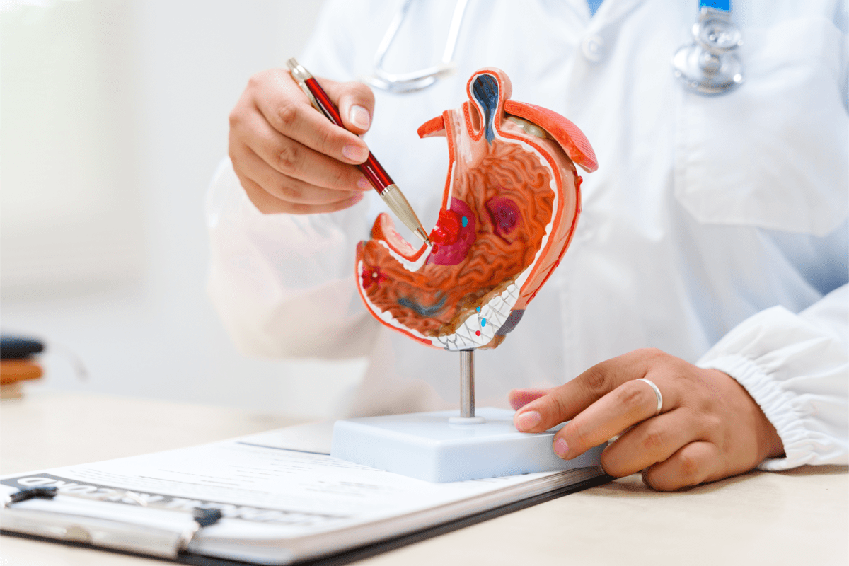 Cancro allo stomaco avanzato, nuova terapia riduce del 42% il rischio di morte ﻿