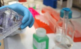 Colite ulcerosa nuovi dati dallo studio Verdict su vedolizumab 265x160