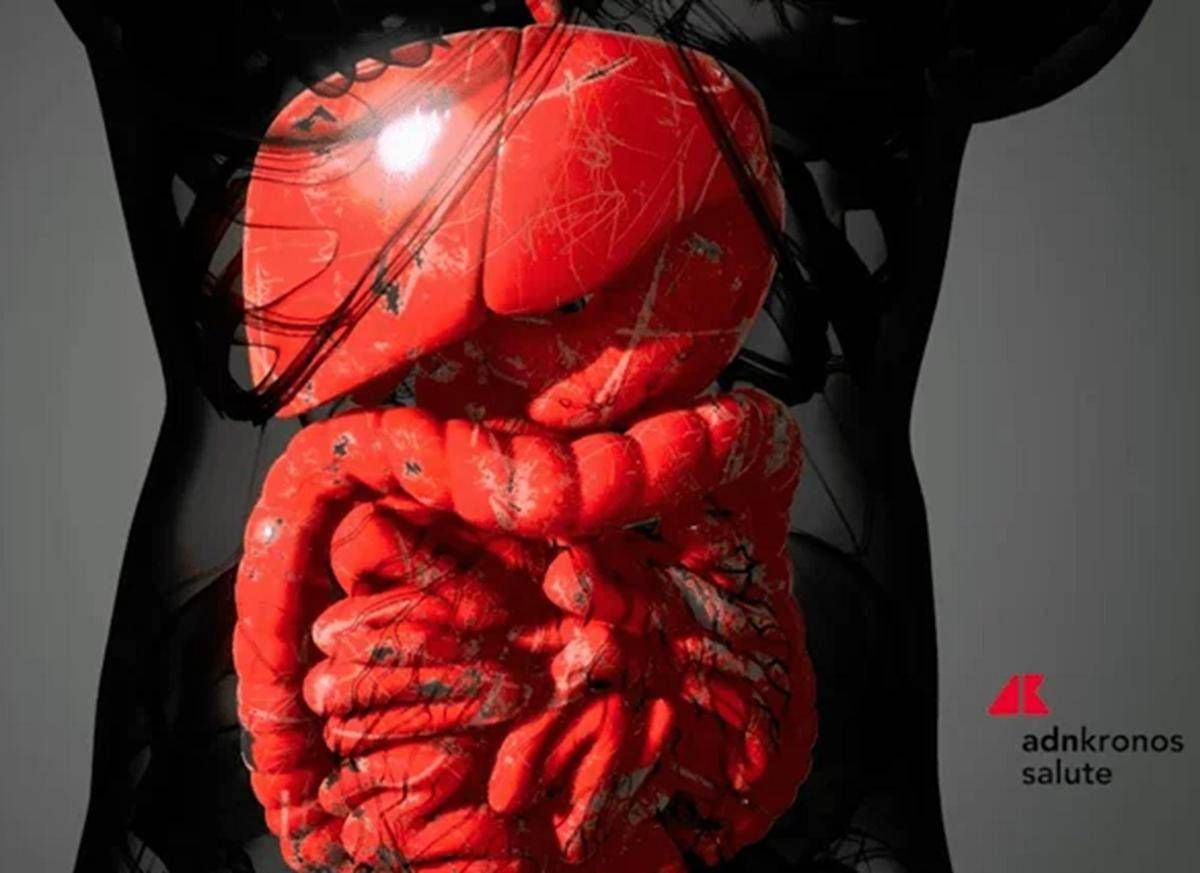 Farmaci, Aifa approva mirikizumab anche nel trattamento della malattia di Crohn