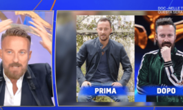Francesco Facchinetti la battaglia contro la calvizie Ho trovato la pace con una patch cutanea 265x160