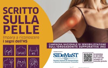 Idrosadenite suppurativa al via campagna di sensibilizzazione Scritto sulla pelle 364x230