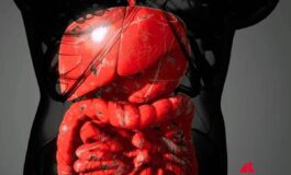 Malattie infiammatorie intestinali rimborsabile guselkumab per colite ulcerosa e Crohn 265x160