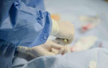 Miracolato tre volte a 85 anni supera terza rottura aorta con complesso intervento 364x230