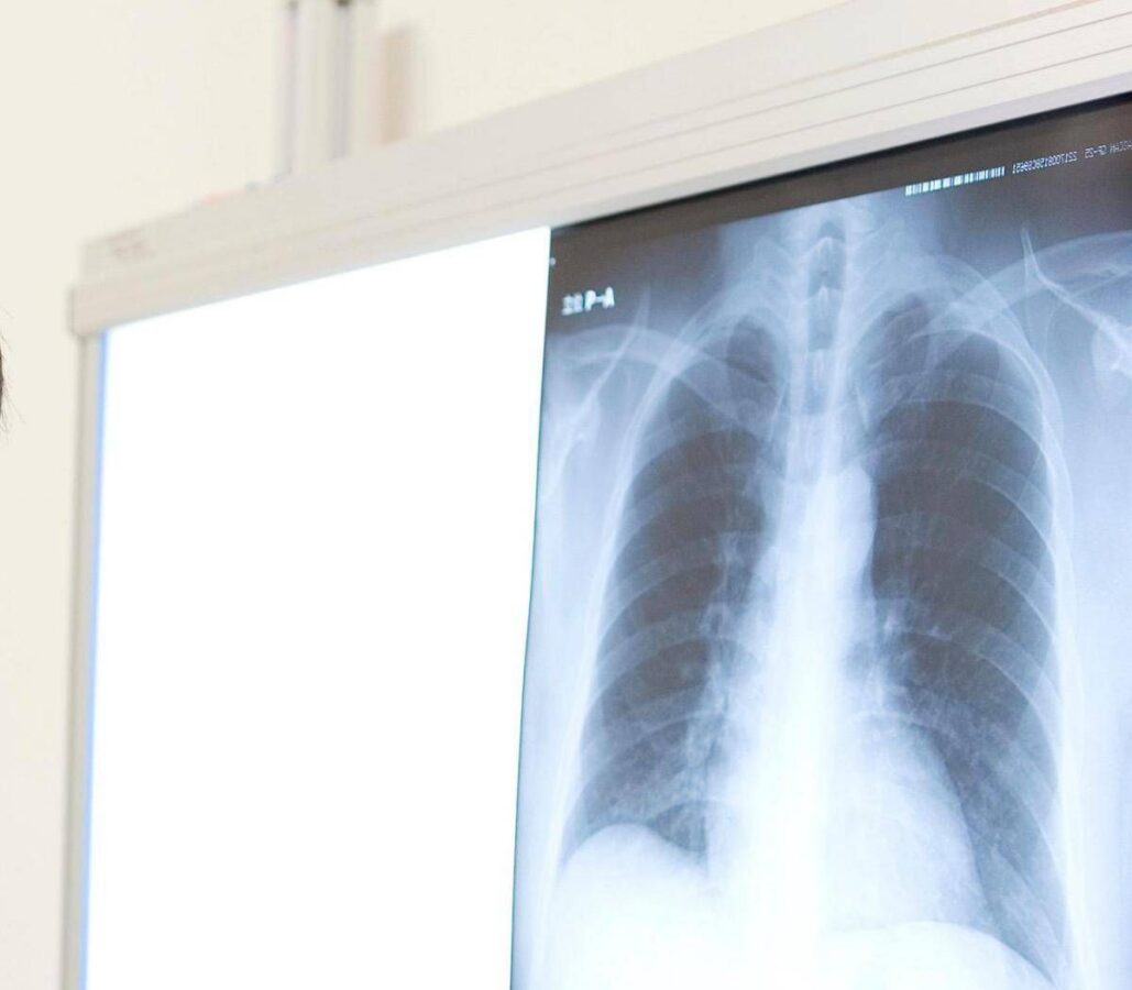 Lungenpest in Sibirien: EU beobachtet die Lage genau: Was Experten sagen