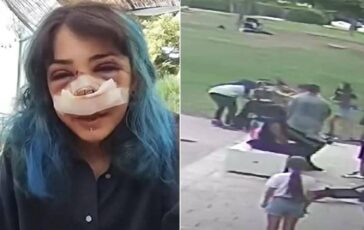 Picchiata al Parco Rossani processo al via il 4 novembre la 26enne ha pubblicato il video dellaggressione 364x230