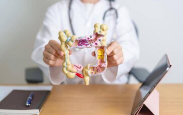 Salvatore Gemelli Immunoterapia puo evitare radio chemio e chirurgia nel cancro al retto 364x230