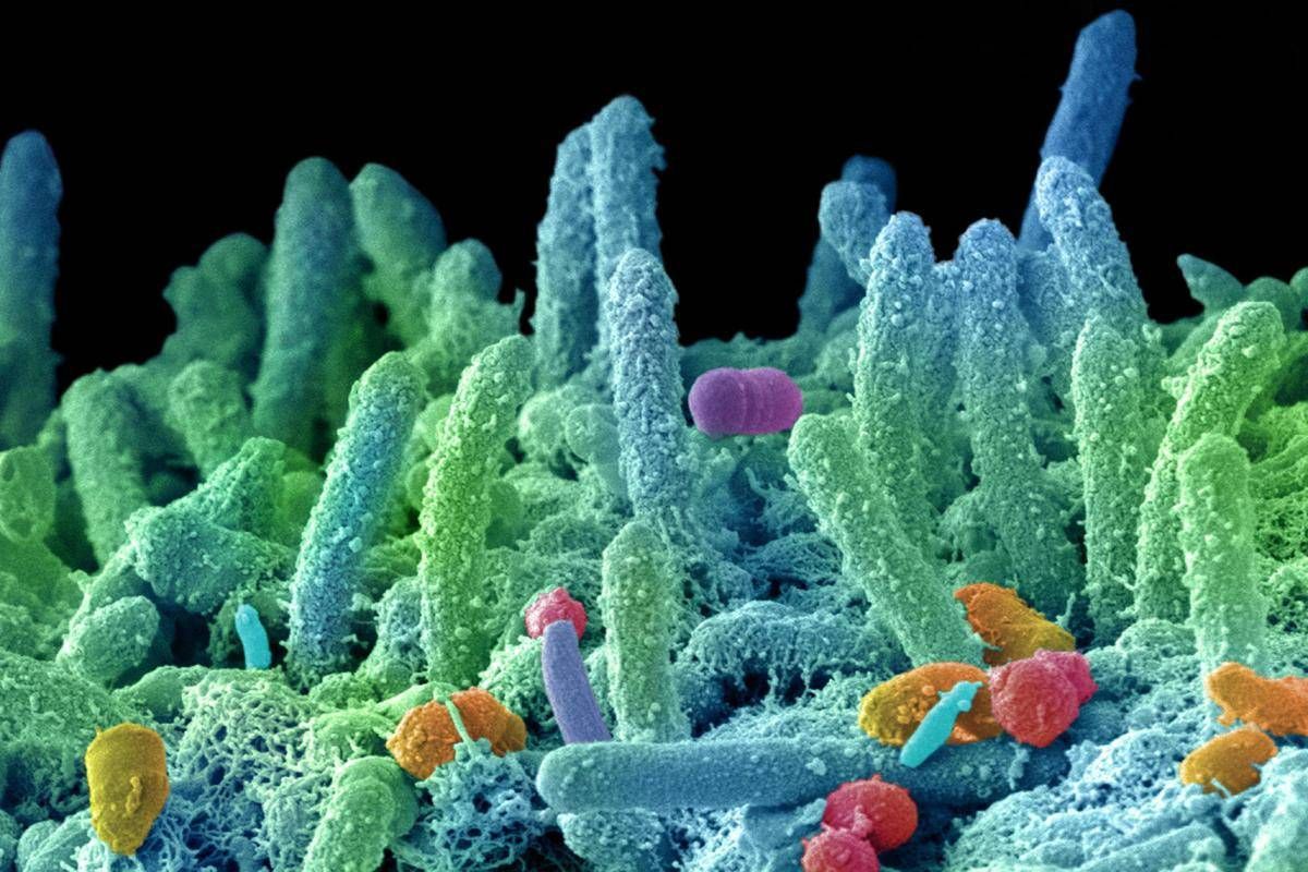 "Super batteri nuova pandemia", appello microbiologi: fondi certi in Manovra e politiche ambientali﻿