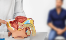 Tumore prostata ad alto rischio recidiva nuova terapia riduce del 58 rischio morte o metastasi 265x160