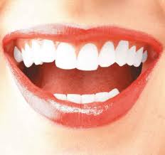 Sconti Milano per una correzione dentale invisibile su entrambe le arcate
