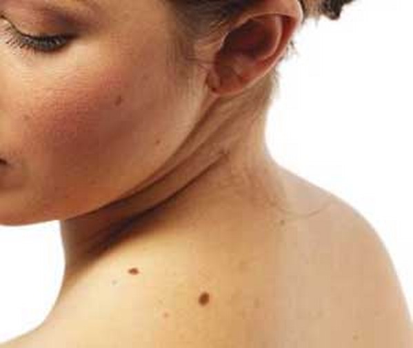 Sconti Milano per visita dermatologica con mappatura nei