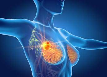 Per cancro seno la cura che arriva dal gelo, Ieo: “Verso un futuro no bisturi”
