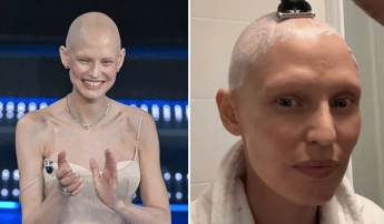 bianca balti nuova terapia contro il tumore per riparare il dna danneggiato 2