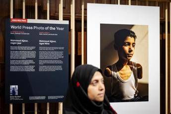 World Press Photo, nella foto dell’anno un bambino mutilato a Gaza