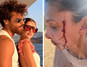 Can Yaman, la fidanzata Sara Bluma denuncia le violenze dell’ex. L’attore: “Ti amo”