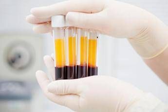 Manovra, Associazione immunodeficienze primitive: “Agire su plasmaderivati”