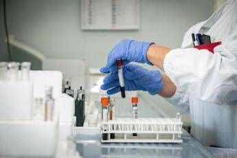 epatite a crescono i casi sesso e alimenti come si prende e sintomi 2