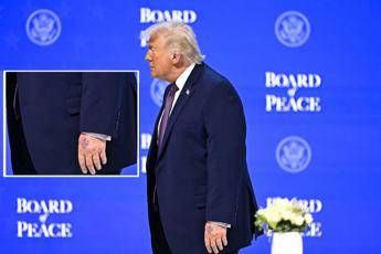 Trump, nuovo grande livido sul dorso della mano sinistra: il dettaglio non passa inosservato