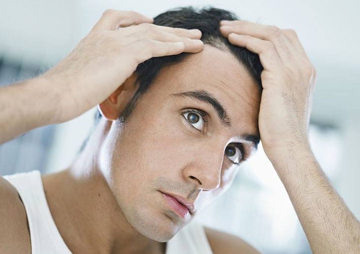 Cause e soluzioni naturali per la caduta dei capelli negli uomini