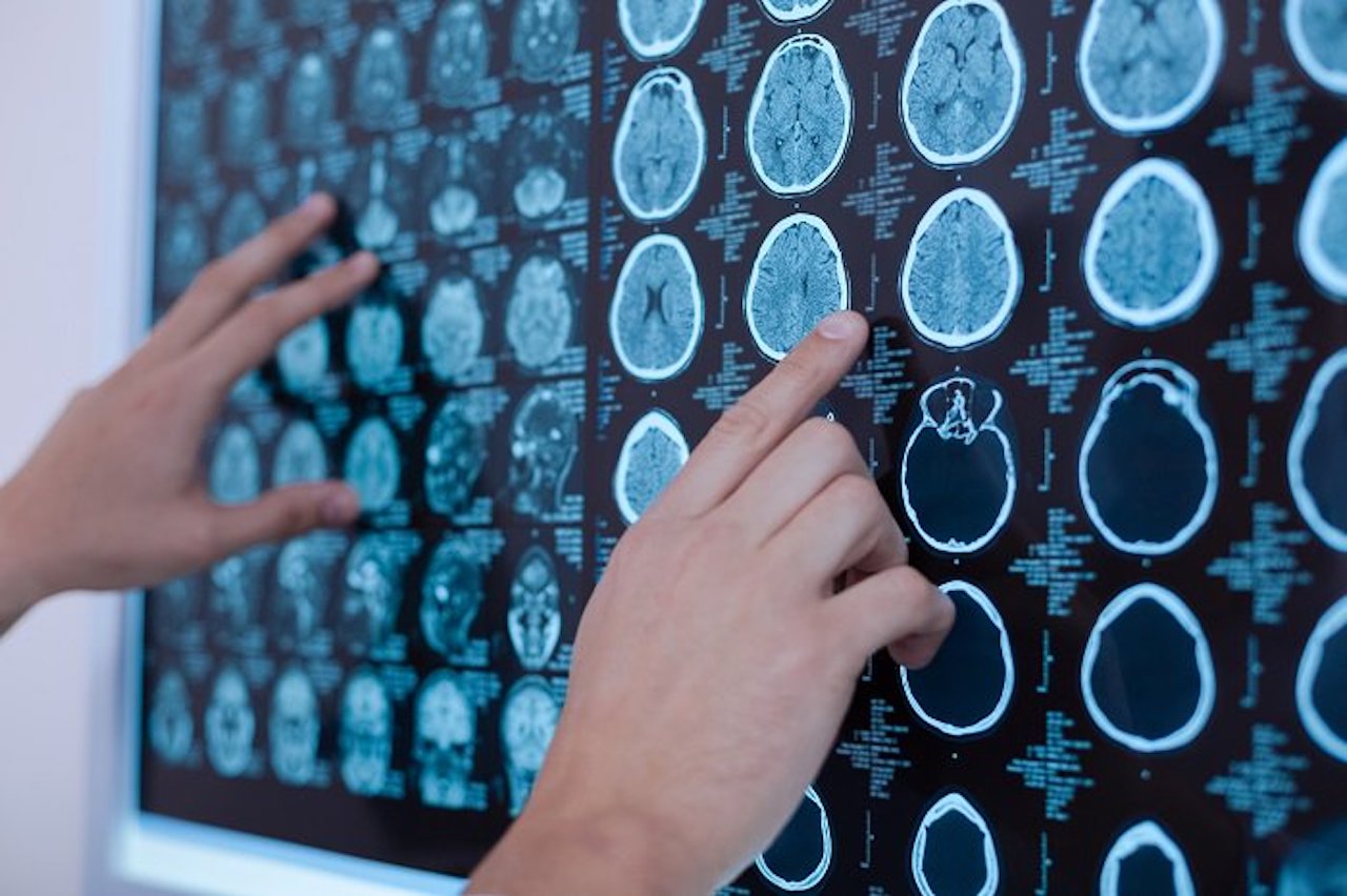 AI assistenza sanitaria