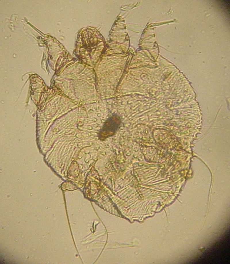 800px Sarcoptes scabei 2
