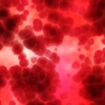 diabete