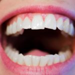 sbiancare denti fragole
