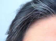stress e capelli bianchi