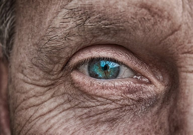 pelle sensibile: caratteristiche, cause e rimedi