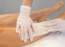 Follicolite post epilazione: i rimedi naturali e quelli farmacologici