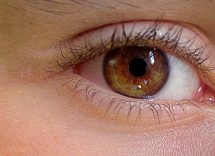 aniridia cure