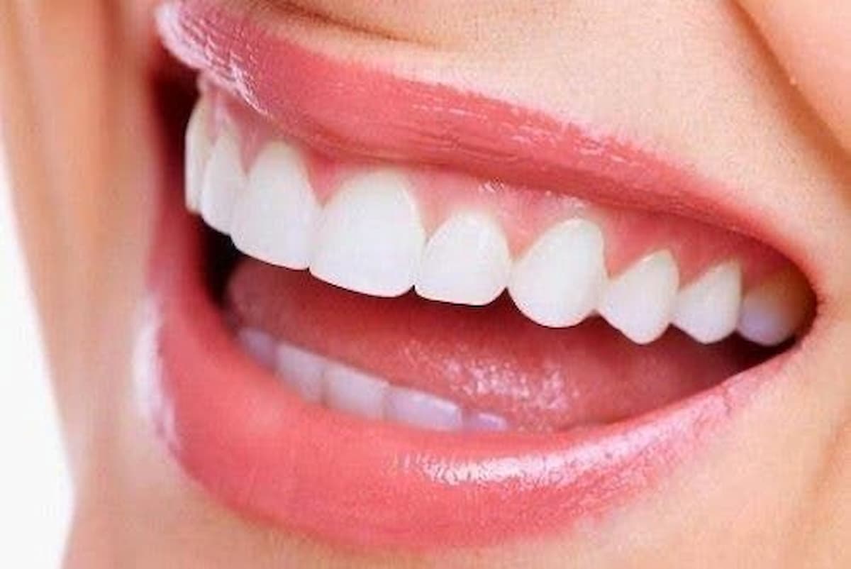come sbiancare denti