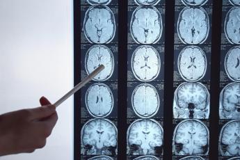 ricerca test su micro sensore gel fa il check up al cervello e si dissolve 2