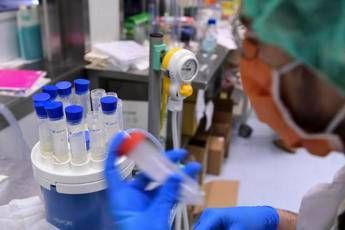 legionella il batterio che ama tubature e condizionatori casi in aumento in italia 2