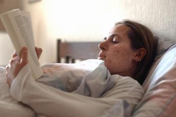 morbillo nicastri spallanzani crescono casi tra adulti vaccino consigliato 2