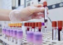 alert su difterite in ue linfezione continua a colpire in europa 2