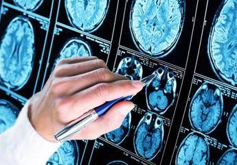 alzheimer 300mila euro a 6 scienziati per diagnosi precoce e prevenzione 3