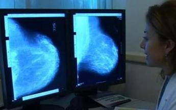 donne operate per tumore al seno 70 paga cure e 30 teme per il lavoro 2