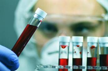 alzheimer allo studio esame del sangue per aiutare diagnosi precoce 2
